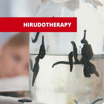 What is Hirudotherapy?